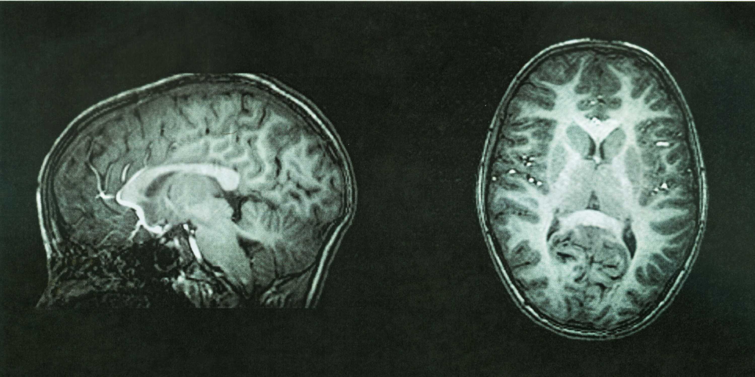 brain images